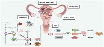 Exosomes: potential diagnostic markers and drug carriers for adenomyosis